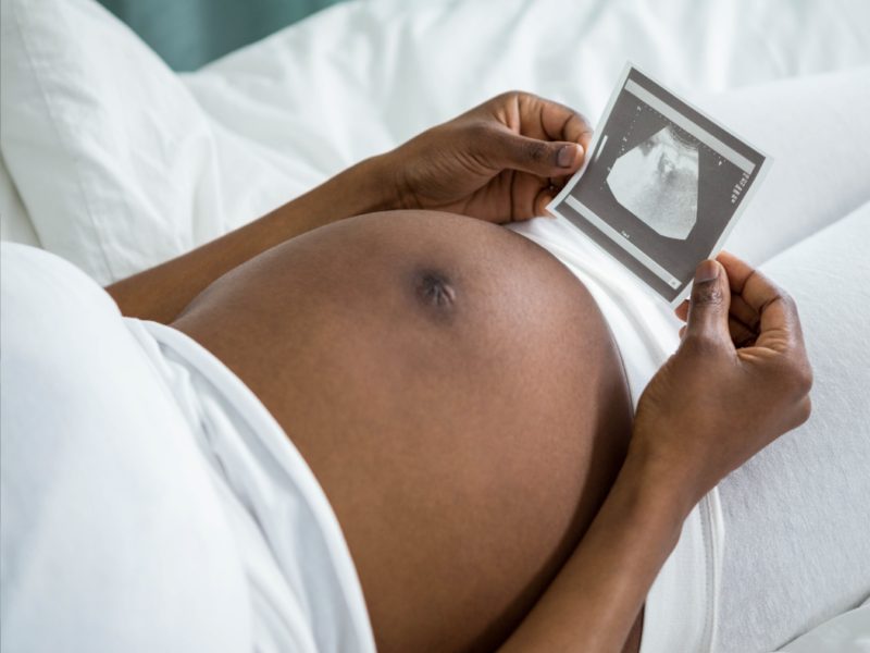 Expectant mother holding an ultrasound photo over her belly